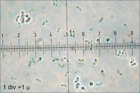 Attēlu rezultāti vaicājumam “Phlebia tremellosa”