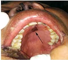 2009/03/post-c2ad.html에 대한 이미지 검색결과