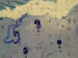 Attēlu rezultāti vaicājumam “Diachea muscorum plasmodium”