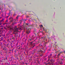 Attēlu rezultāti vaicājumam “Biatoropsis usnearum”