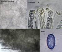 Attēlu rezultāti vaicājumam “Sowerbyella radiculata”