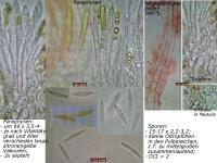 Attēlu rezultāti vaicājumam “Heyderia pusilla”