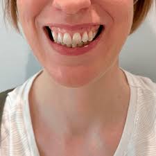 Bildergebnis für smile