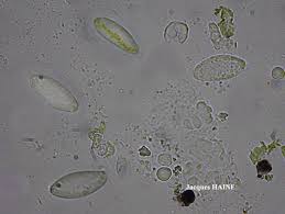 Attēlu rezultāti vaicājumam “Verrucaria hydrela”