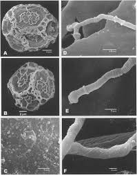Attēlu rezultāti vaicājumam “Oligonema favogineum spores”