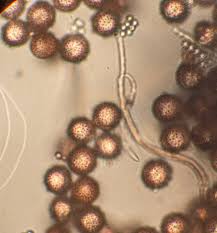 Attēlu rezultāti vaicājumam “Diderma subviridifuscum var. macrospora* sessile”