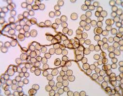 Attēlu rezultāti vaicājumam “Gulielmina vermicularis”