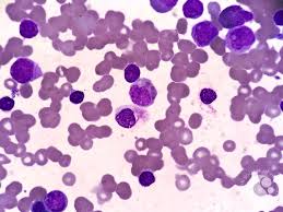 Attēlu rezultāti vaicājumam “Pseudobryum cinclidioides cells”