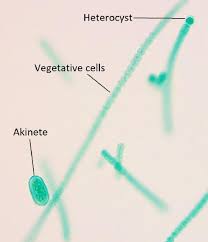 Attēlu rezultāti vaicājumam “Nostoc pruniforme cells”