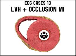 Image result for  ^ L V [ h    