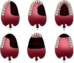 2009/03/post-c2ad.html에 대한 이미지 검색결과