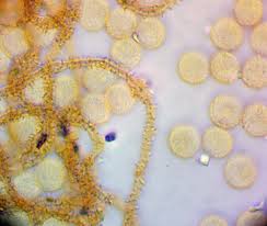 Attēlu rezultāti vaicājumam “Heterotrichia obvelata (syn. Arcyria obvelata) young”