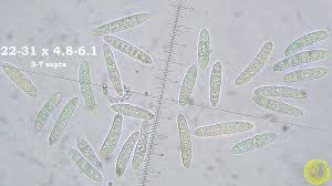 Attēlu rezultāti vaicājumam “Scoliciosporum chlorococcum”