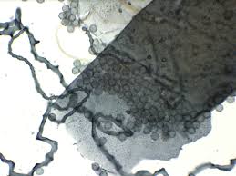 Attēlu rezultāti vaicājumam “Arcyria affinis stalked”