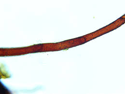 Attēlu rezultāti vaicājumam “Pleuridium subulatum sporophyte”