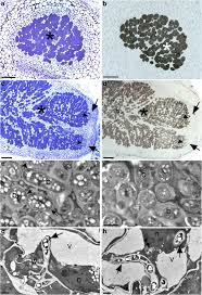 Attēlu rezultāti vaicājumam “Dipogon sp.”