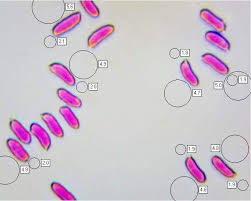 Attēlu rezultāti vaicājumam “Badhamia versicolor spores”