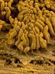 Attēlu rezultāti vaicājumam “Arcyria imperialis”