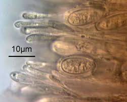 Attēlu rezultāti vaicājumam “Lachnellula willkommii”