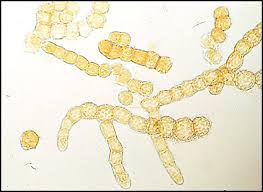 Attēlu rezultāti vaicājumam “Orthotrichum diaphanum sporophyte”