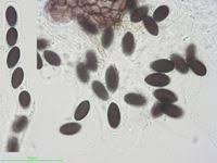 Attēlu rezultāti vaicājumam “Sordaria fimicola”