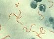 Streptococcus pyogenes - Wikipedia, the free encyclopedia