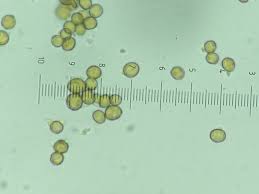 Attēlu rezultāti vaicājumam “Chaenotheca trichialis”