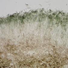 Attēlu rezultāti vaicājumam “Hypocenomyce scalaris”