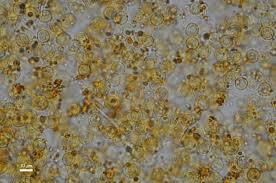 Attēlu rezultāti vaicājumam “Perichaena corticalis spores”