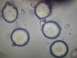 Attēlu rezultāti vaicājumam “Licea pygmaea spores”