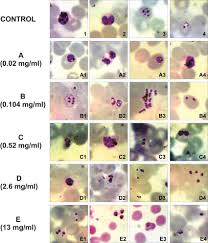 Attēlu rezultāti vaicājumam “Siphoptychium violaceum plasmodium”