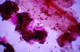 Attēlu rezultāti vaicājumam “Dianema nivale spores”