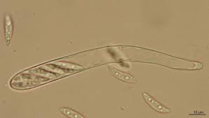 Attēlu rezultāti vaicājumam “Hymenoscyphus calyculus”