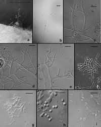 Attēlu rezultāti vaicājumam “Hypocrea rufa”