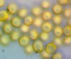 Attēlu rezultāti vaicājumam “Hemitrichia sordivesiculosa spores”