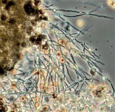 Attēlu rezultāti vaicājumam “Didymium bahiense stalked”