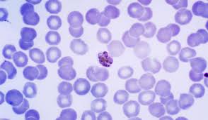 Attēlu rezultāti vaicājumam “Cribraria purpurea plasmodium”