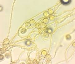 Attēlu rezultāti vaicājumam “Perichaena depressa”