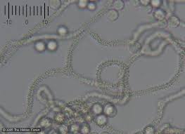 Attēlu rezultāti vaicājumam “Arcyria cinerea spores”