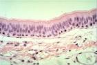 Epithelial Tissues