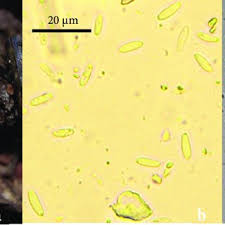 Attēlu rezultāti vaicājumam “Chlorencoelia versiformis”