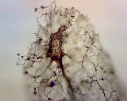 Attēlu rezultāti vaicājumam “Stemonitis marjana stalked”