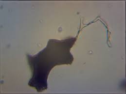 Attēlu rezultāti vaicājumam “Physarum bryomacrocarpum spores”
