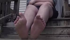 Image result for Amazing Feet Rc, Kidderminster