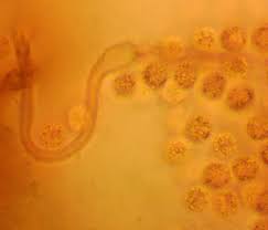 Attēlu rezultāti vaicājumam “Lycogala sphaeroconicum sessile”