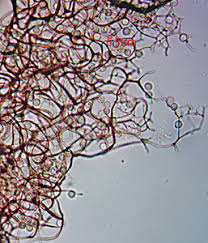 Attēlu rezultāti vaicājumam “Stemonitopsis hyperopta var. landewaldii”