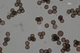 Attēlu rezultāti vaicājumam “Badhamia lilacina var. megaspora sessile”