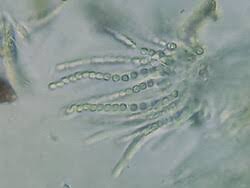 Attēlu rezultāti vaicājumam “Hypocrea pulvinata”