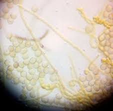 Attēlu rezultāti vaicājumam “Lycogala ustulatum macro”