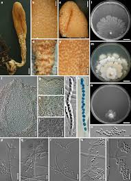 Attēlu rezultāti vaicājumam “Hypocrea rufa”